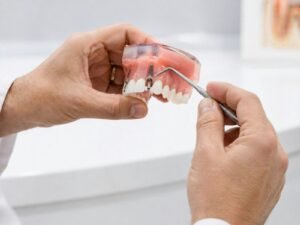 Same-Day Dental Implants: What “Teeth in a Day” Really Means