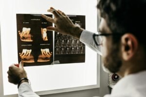 Sinus Lift for Dental Implants: What Patients Should Know